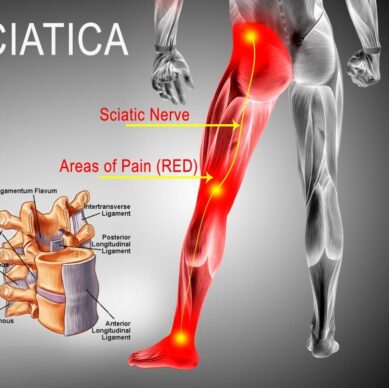 sciatica-pain-colorado-pain-care-blog-1024x768
